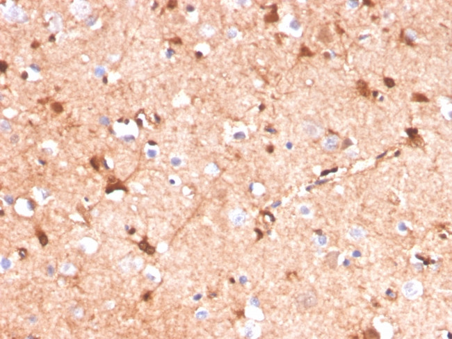 S100B (Astrocyte and Melanoma Marker) Antibody in Immunohistochemistry (Paraffin) (IHC (P))