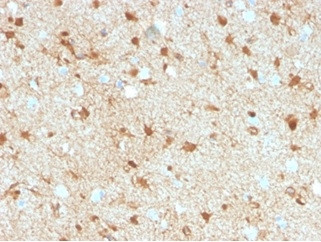 S100B (Astrocyte and Melanoma Marker) Antibody in Immunohistochemistry (Paraffin) (IHC (P))