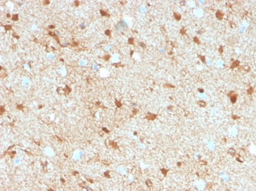 S100B (Astrocyte and Melanoma Marker) Antibody in Immunohistochemistry (Paraffin) (IHC (P))