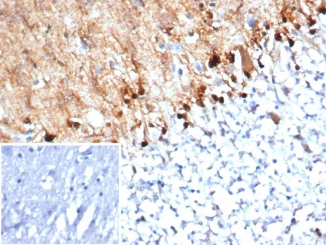 S100B (Astrocyte and Melanoma Marker) Antibody in Immunohistochemistry (Paraffin) (IHC (P))