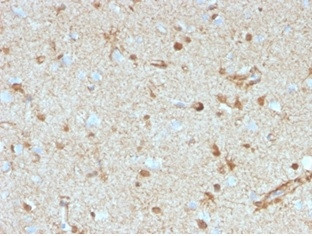 S100B (Astrocyte and Melanoma Marker) Antibody in Immunohistochemistry (Paraffin) (IHC (P))