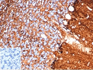 S100B (Astrocyte and Melanoma Marker) Antibody in Immunohistochemistry (Paraffin) (IHC (P))