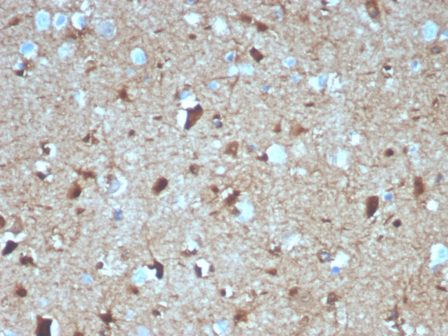 S100B (Astrocyte and Melanoma Marker) Antibody in Immunohistochemistry (Paraffin) (IHC (P))