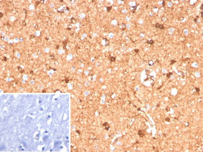 S100B (Astrocyte and Melanoma Marker) Antibody in Immunohistochemistry (Paraffin) (IHC (P))