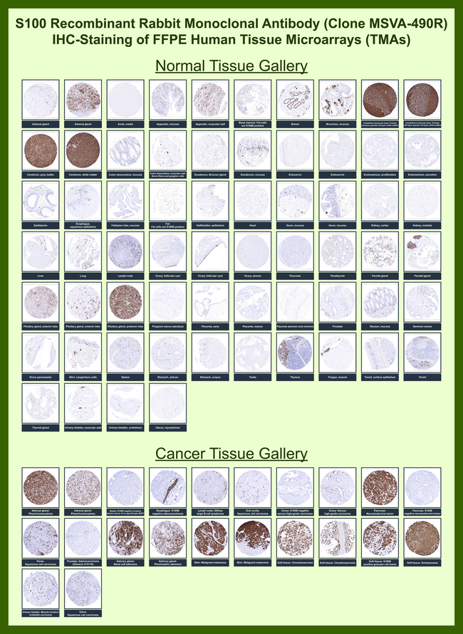 S100B (Astrocyte and Melanoma Marker) Antibody in Immunohistochemistry (Paraffin) (IHC (P))