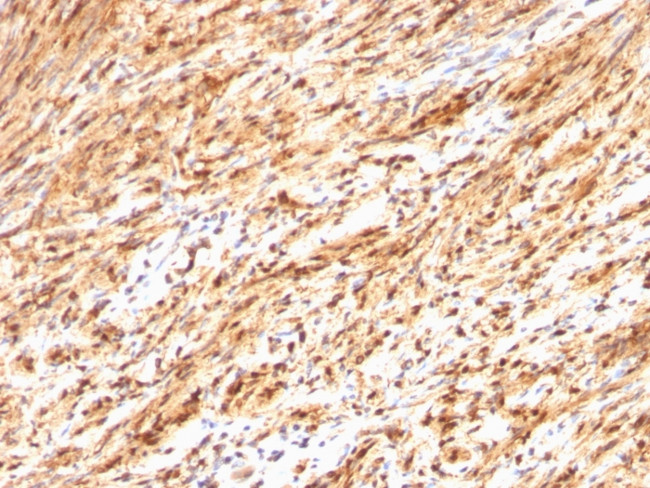 S100B (Astrocyte and Melanoma Marker) Antibody in Immunohistochemistry (Paraffin) (IHC (P))