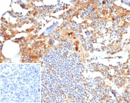 S100P/MIG9 Antibody in Immunohistochemistry (Paraffin) (IHC (P))