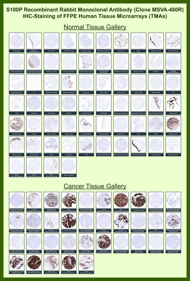 S100P Antibody in Immunohistochemistry (Paraffin) (IHC (P))