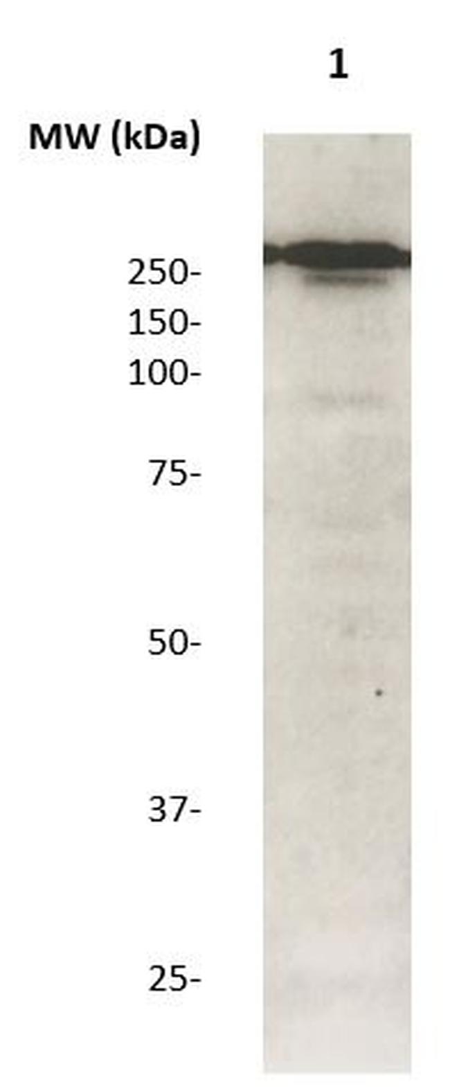 Phospho-LRRK2 (Thr1491) Antibody in Western Blot (WB)