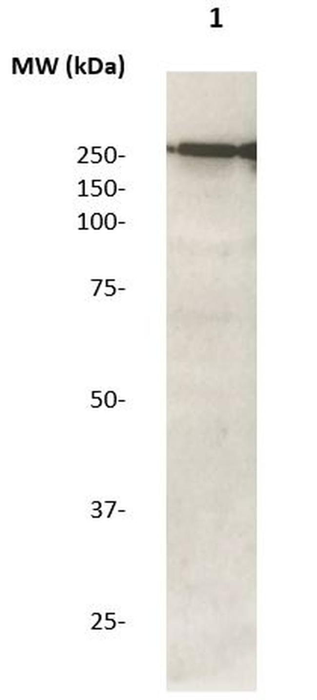 Phospho-LRRK2 (Thr1503) Antibody in Western Blot (WB)