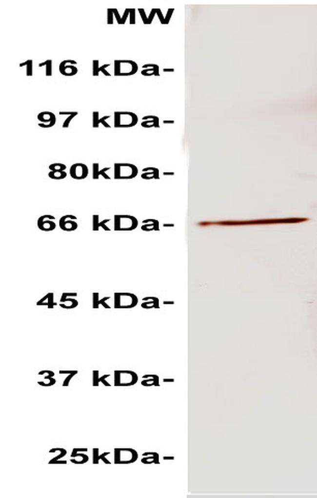 Phospho-AEG1 (Ser568) Antibody in Western Blot (WB)