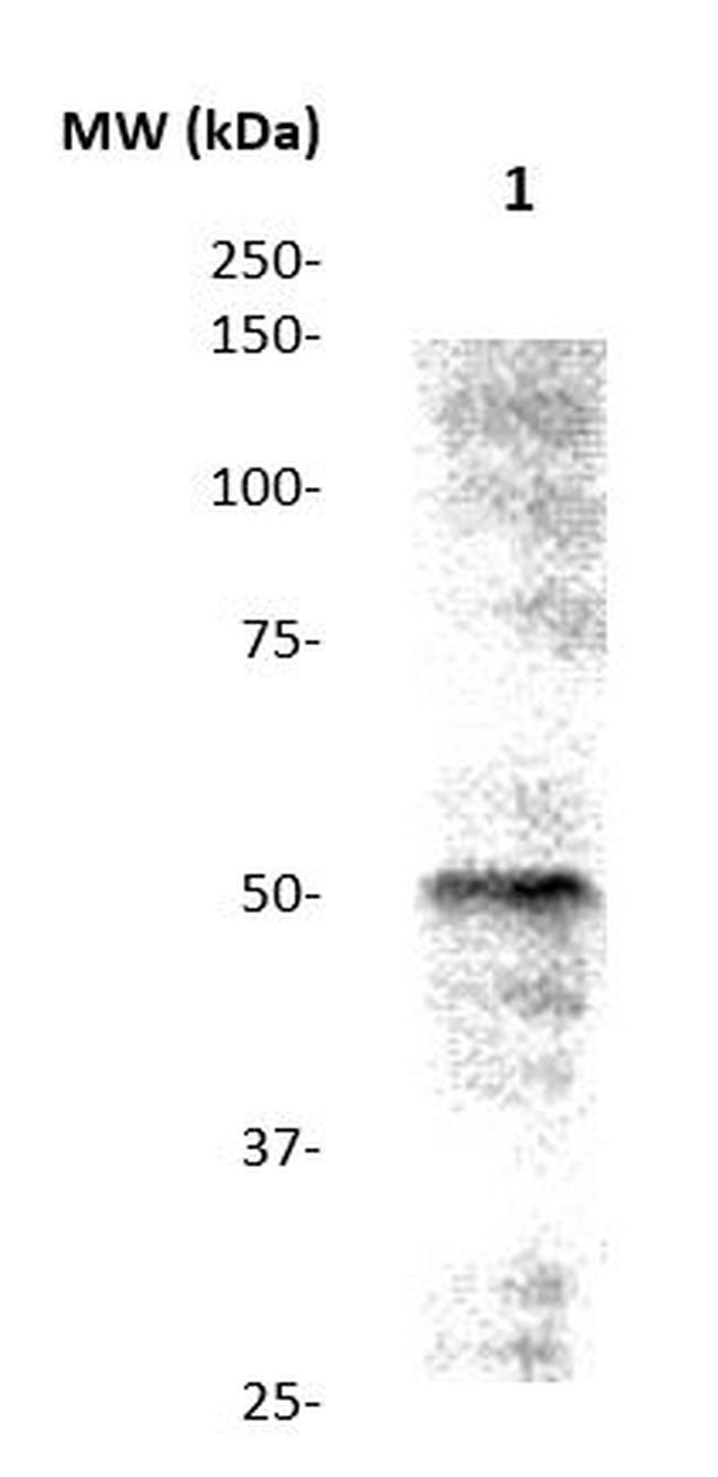 SERPINC1/AT3 (Antithrombin 3) Antibody in Western Blot (WB)