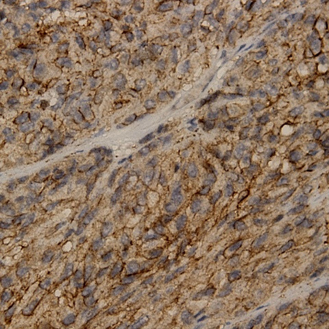 ECRG4 Antibody in Immunohistochemistry (Paraffin) (IHC (P))