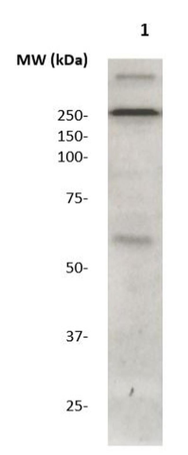 Phospho-LRRK2 (Ser955) Antibody in Western Blot (WB)