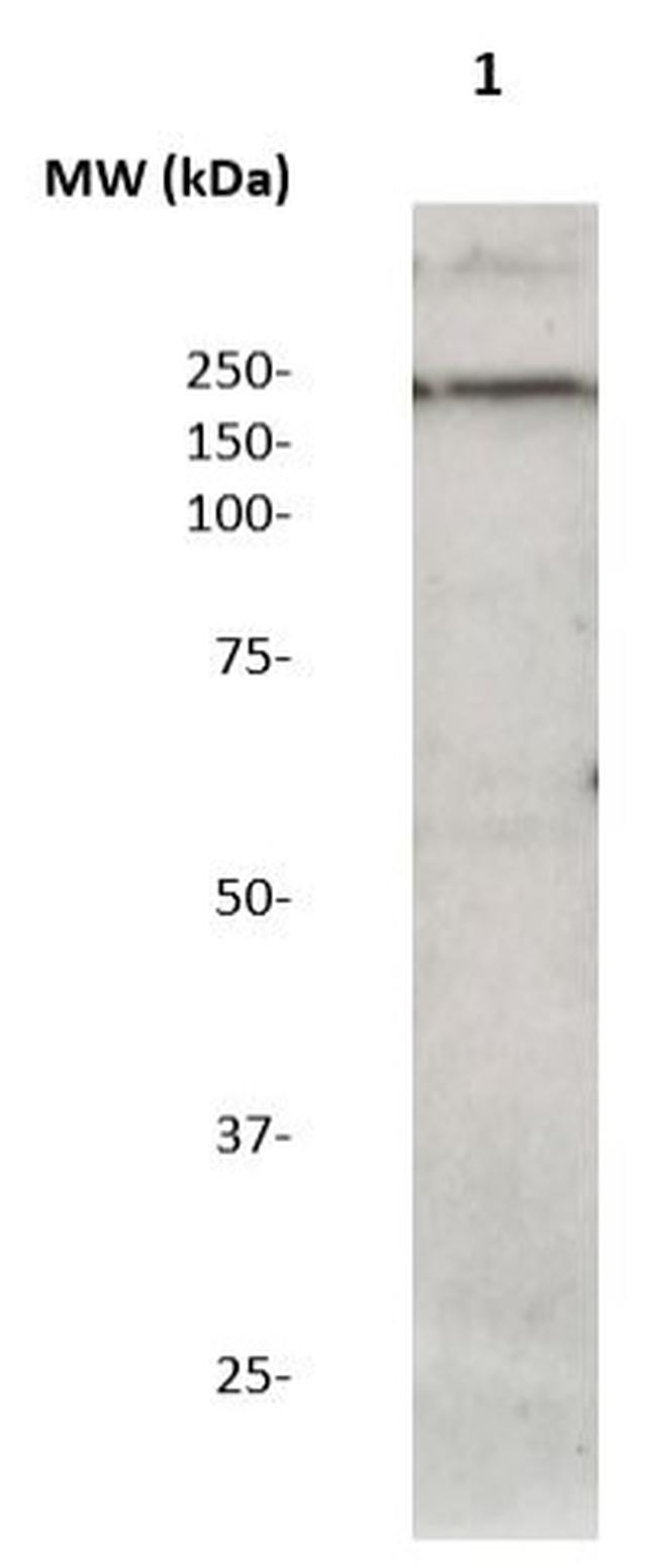 Phospho-LRRK2 (Ser973) Antibody in Western Blot (WB)
