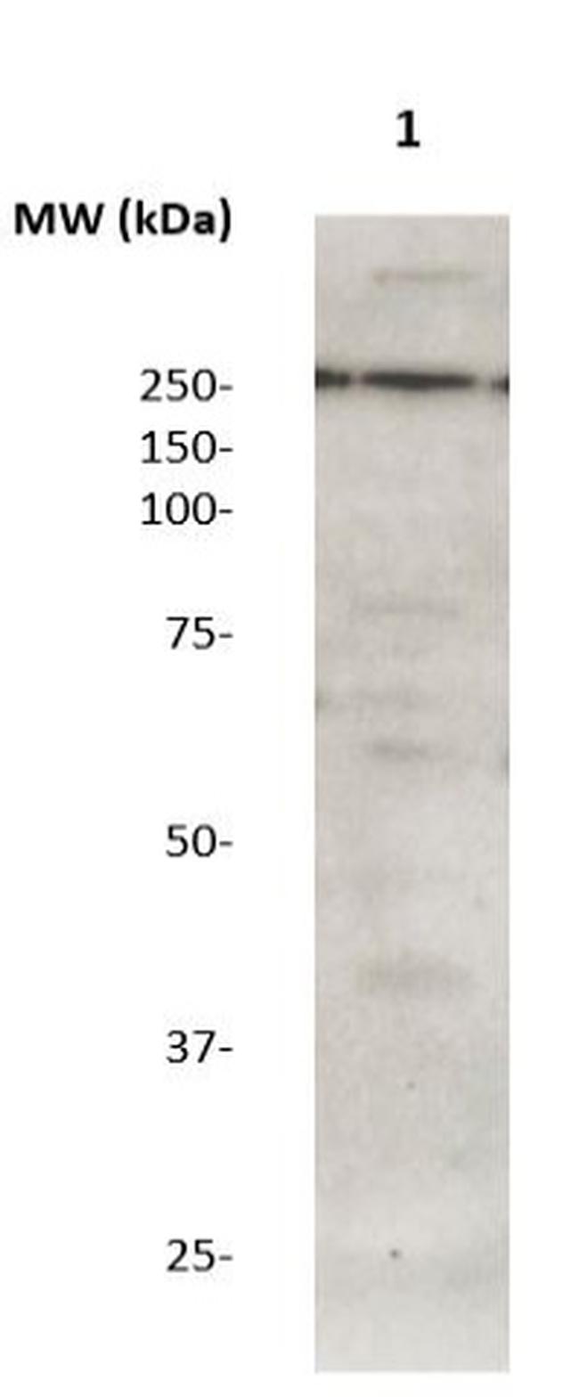 LRRK2 Antibody in Western Blot (WB)