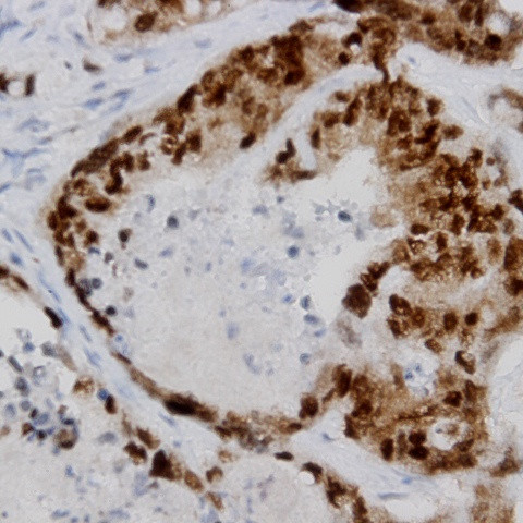 TOR2A Antibody in Immunohistochemistry (Paraffin) (IHC (P))