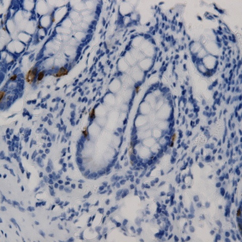 CNPY4 Antibody in Immunohistochemistry (Paraffin) (IHC (P))