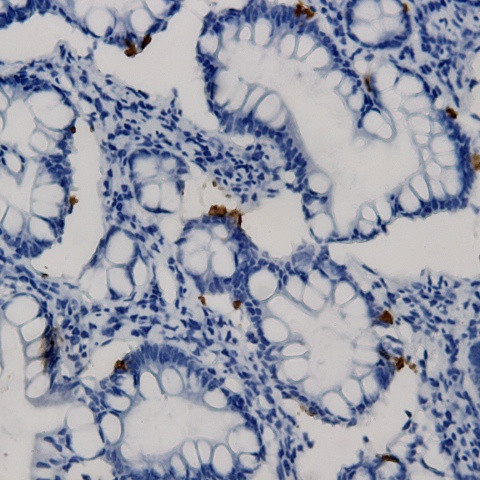 SCG2 (Secretogranin II) Antibody in Immunohistochemistry (Paraffin) (IHC (P))