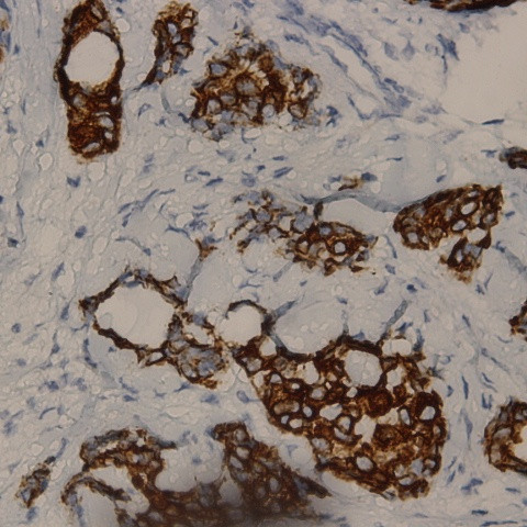 Phospho-Raf-A (Ser186) Antibody in Immunohistochemistry (Paraffin) (IHC (P))