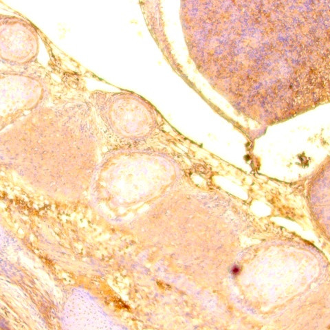 Phospho-Crystallin (A-Beta) (Ser59) Antibody in Immunohistochemistry (Paraffin) (IHC (P))
