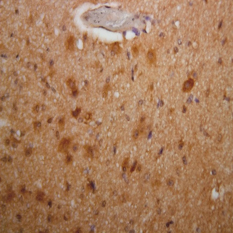 Phospho-Parkin (Ser56) Antibody in Immunohistochemistry (Paraffin) (IHC (P))