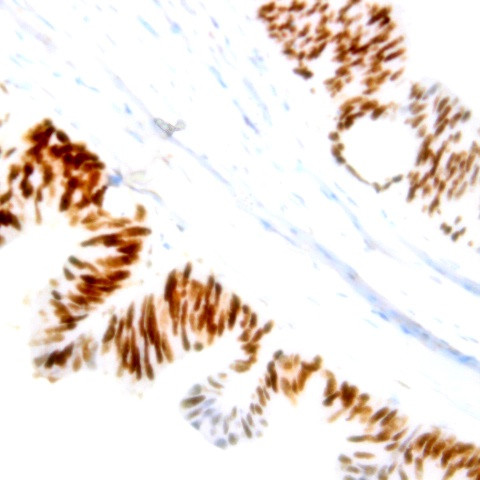 Phospho-Nucleophosmin (NPM) (Ser70) Antibody in Immunohistochemistry (Paraffin) (IHC (P))