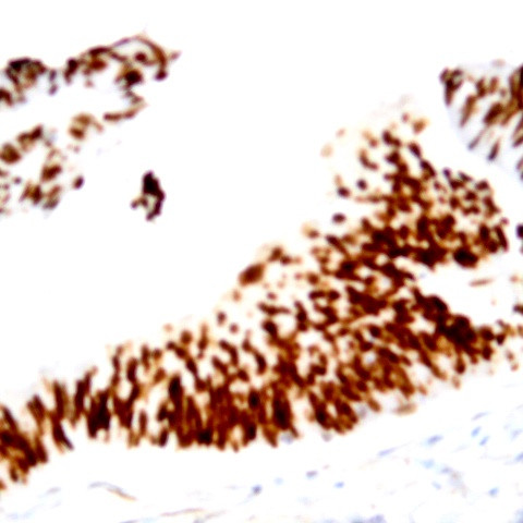 Nucleophosmin (NPM) Antibody in Immunohistochemistry (Paraffin) (IHC (P))