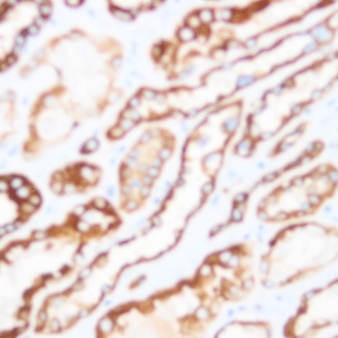 Phospho-Neuropilin-1 (Tyr297) Antibody in Immunohistochemistry (Paraffin) (IHC (P))