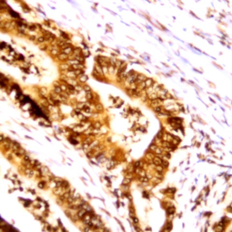 Phospho-DCLK1 (Ser30) Antibody in Immunohistochemistry (Paraffin) (IHC (P))