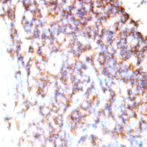 CD44 Antibody in Immunohistochemistry (Paraffin) (IHC (P))