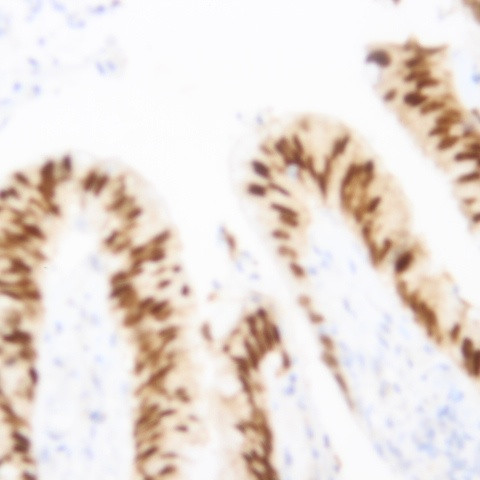 SirT1 Antibody in Immunohistochemistry (Paraffin) (IHC (P))