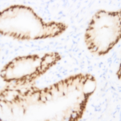 Phospho-SirT1 (Ser47) Antibody in Immunohistochemistry (Paraffin) (IHC (P))
