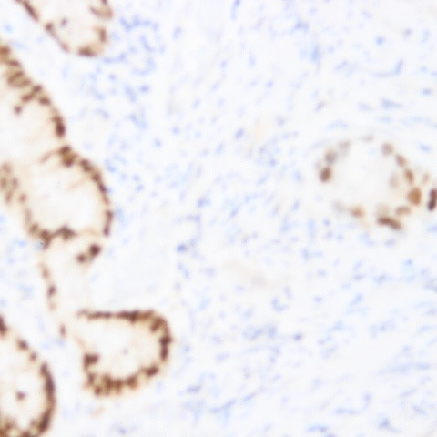 SirT2 Antibody in Immunohistochemistry (Paraffin) (IHC (P))