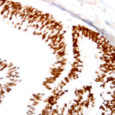 MyoD1 Antibody in Immunohistochemistry (Paraffin) (IHC (P))