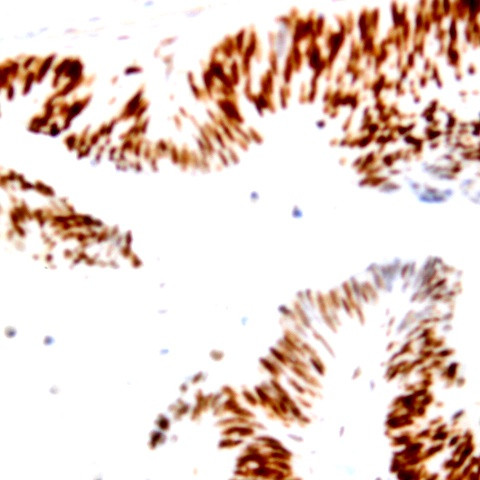 SNAI-2 Antibody in Immunohistochemistry (Paraffin) (IHC (P))