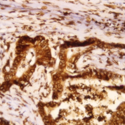 Phospho-ALK/p80 (Tyr1282, Tyr1283) Antibody in Immunohistochemistry (Paraffin) (IHC (P))