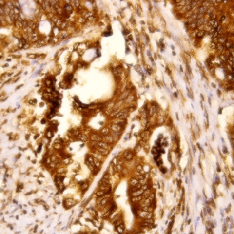 ALK/p80 Antibody in Immunohistochemistry (Paraffin) (IHC (P))