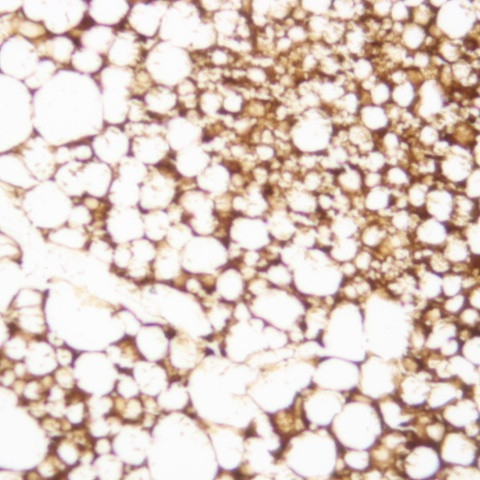 MLH1 Antibody in Immunohistochemistry (Paraffin) (IHC (P))