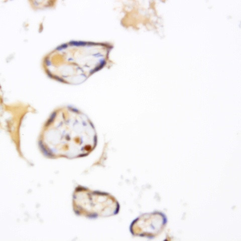 MSH2 Antibody in Immunohistochemistry (Paraffin) (IHC (P))