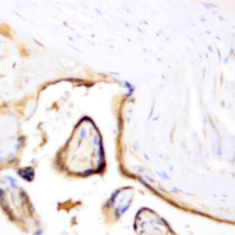 MSH6 Antibody in Immunohistochemistry (Paraffin) (IHC (P))