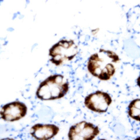 PMS2 Antibody in Immunohistochemistry (Paraffin) (IHC (P))