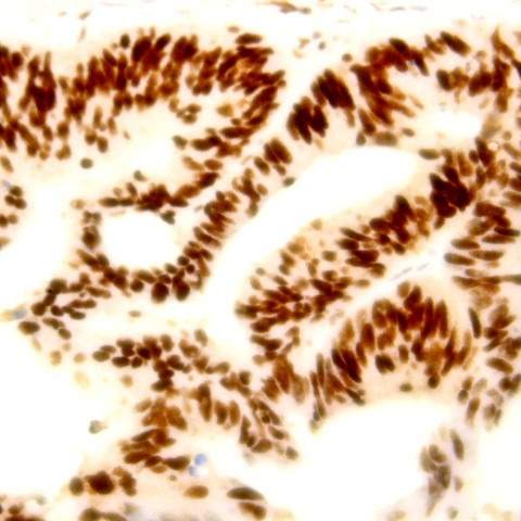 PD-1 Antibody in Immunohistochemistry (Paraffin) (IHC (P))