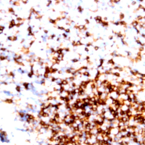 CD13 Antibody in Immunohistochemistry (Paraffin) (IHC (P))