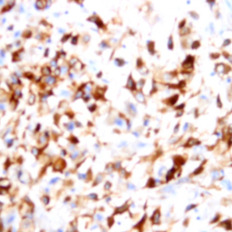 CD81 Antibody in Immunohistochemistry (Paraffin) (IHC (P))