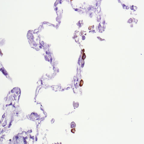 SARS-CoV2 (S1) Antibody in Immunohistochemistry (Paraffin) (IHC (P))