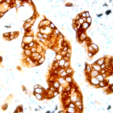 Phospho-AXL/UFO (Tyr812) Antibody in Immunohistochemistry (Paraffin) (IHC (P))