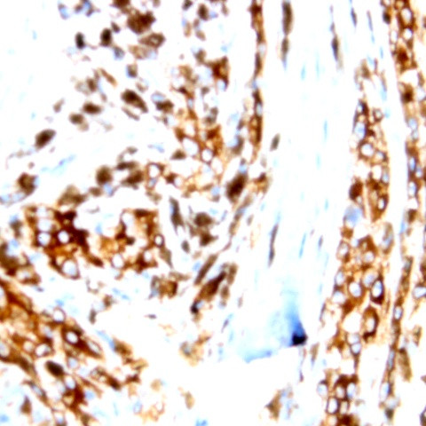 Phospho-AXL/UFO (Tyr770) Antibody in Immunohistochemistry (Paraffin) (IHC (P))