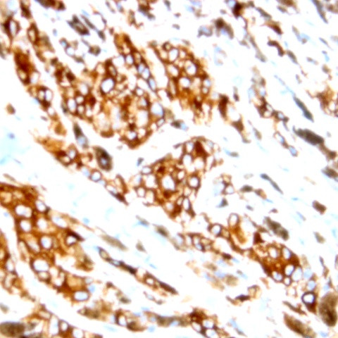 Phospho-AXL/UFO (Tyr857) Antibody in Immunohistochemistry (Paraffin) (IHC (P))