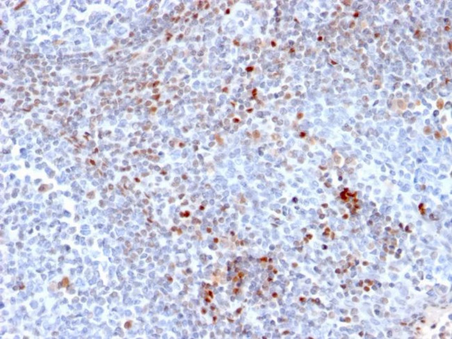 SATB1 (Marker of Lymph Node Metastasis of CRC) Antibody in Immunohistochemistry (Paraffin) (IHC (P))